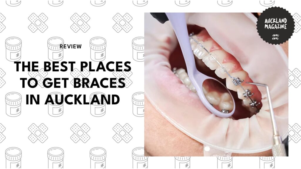 The Top 7 Places to Get Braces in Auckland for Straight Smiles  