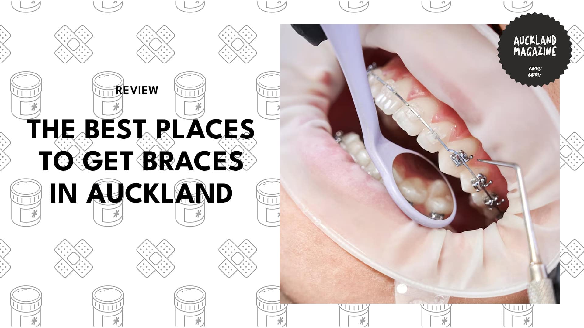 braces-in-auckland