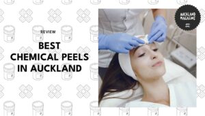 chemical-peels-in-auckland