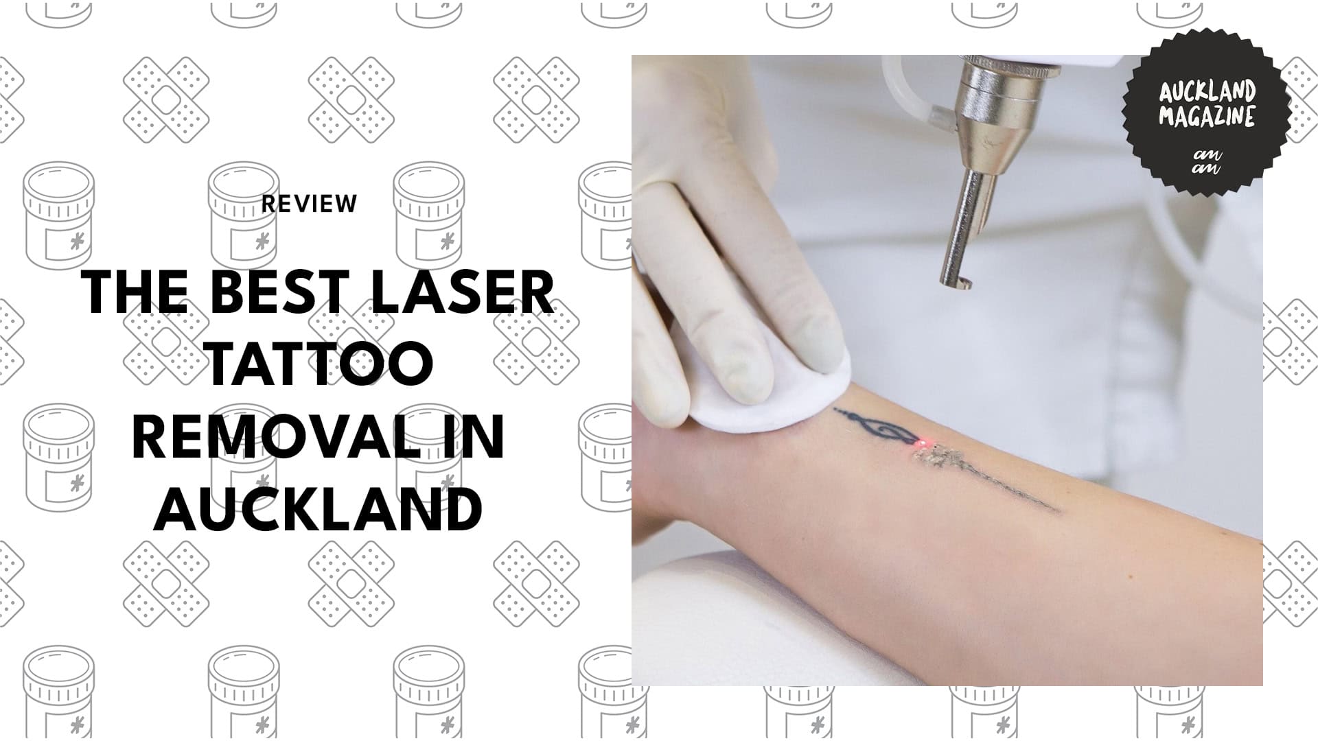laser-tattoo-removal-in-auckland